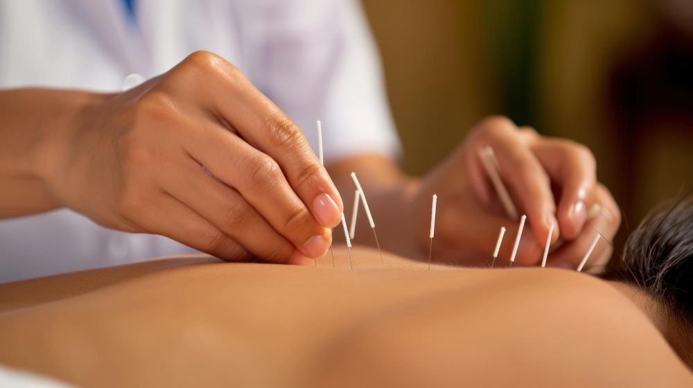 “L’agopuntura a Varese: un altro modo di curare il dolore con la dottoressa Rita Flavia Mantovani”